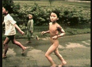 Kim Phuc Skin Peels off Kim's body running from Napalm Blast