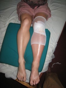 leg2