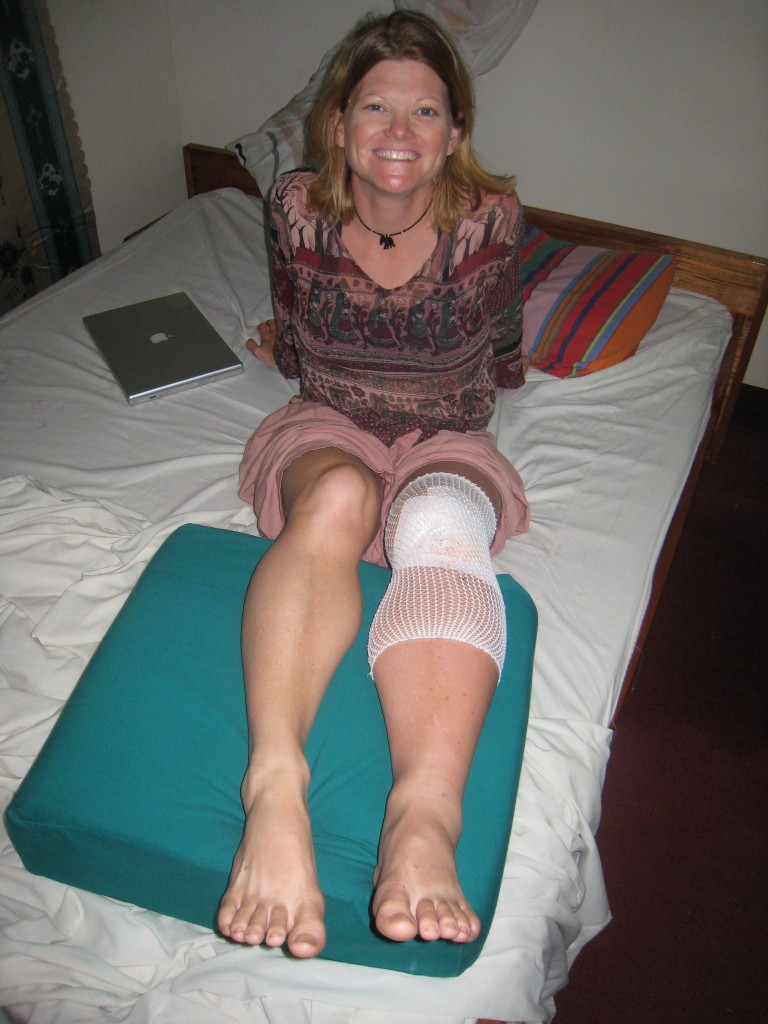 My Knee Infection Slowly Healing