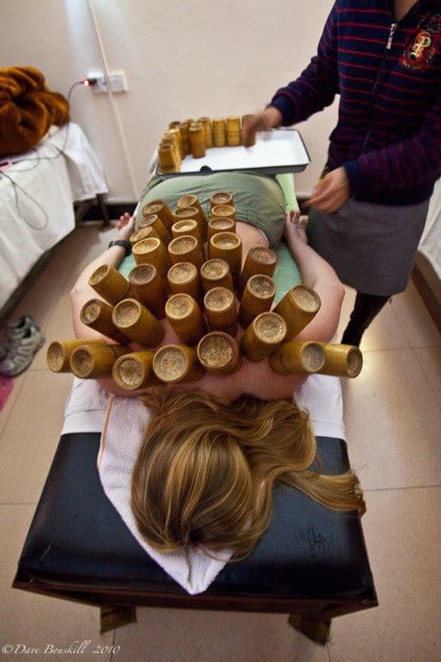 what to do in china hot cupping